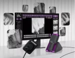سنسور Xpedent RVG سایز 1.5 - Image 5